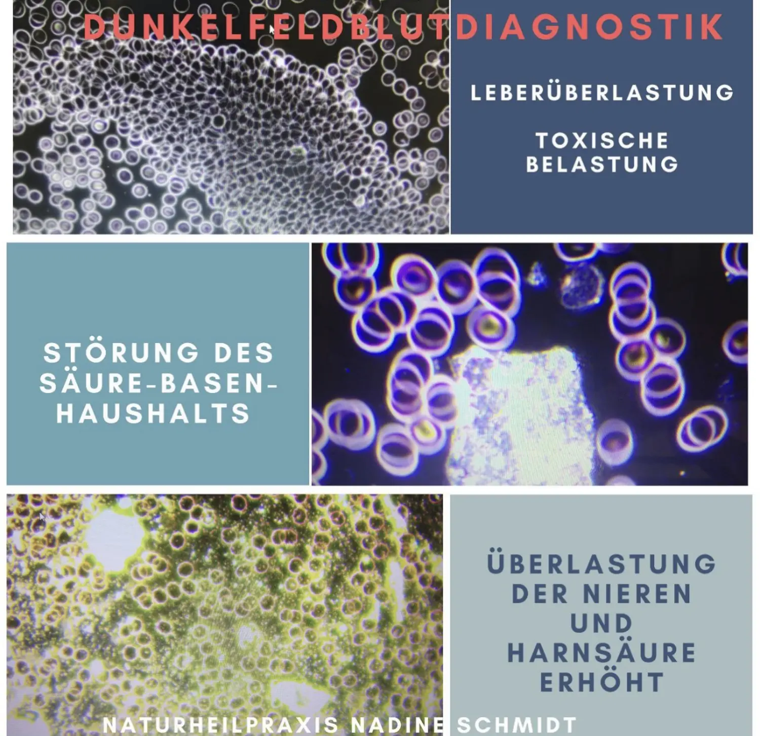 Nadine Schmidt - Naturheilpraxis, Mikroskopische Aufnahmen von Blutzellen